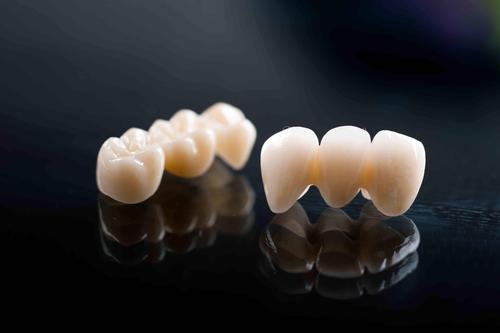 Innovative Recycling采用回收再利用的碳纤维制造假牙