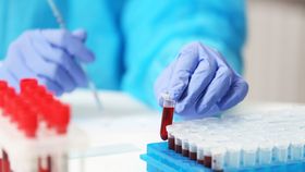 微塑料确实存在于人类体内的循环系统中