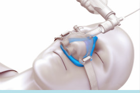 首款由医用TPE制成的仅掩盖鼻子部位的氧气面罩面世