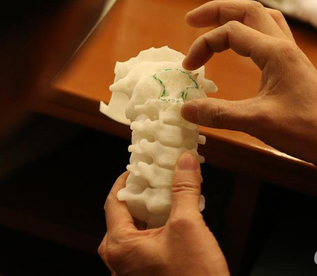 3D打印在医疗行业运用愈趋宽广