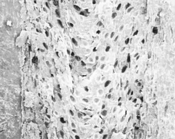 热塑性塑料发泡材料的四大成型工艺